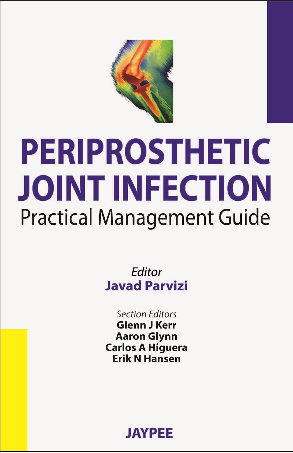 Periprosthetic Joint Infection: Practical Management Guide,Used