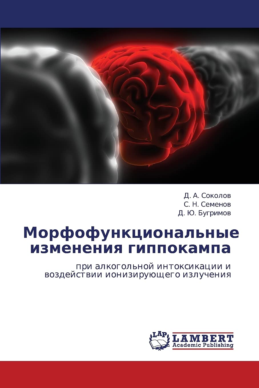 Morfofunktsional'nye izmeneniya gippokampa: pri alkogol'noy intoksikatsii i vozdeystvii ioniziruyushchego izlucheniya (Russian E,Used