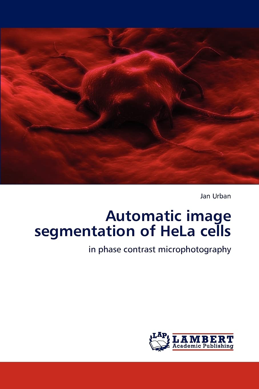 Automatic image segmentation of HeLa cells: in phase contrast microphotography,Used