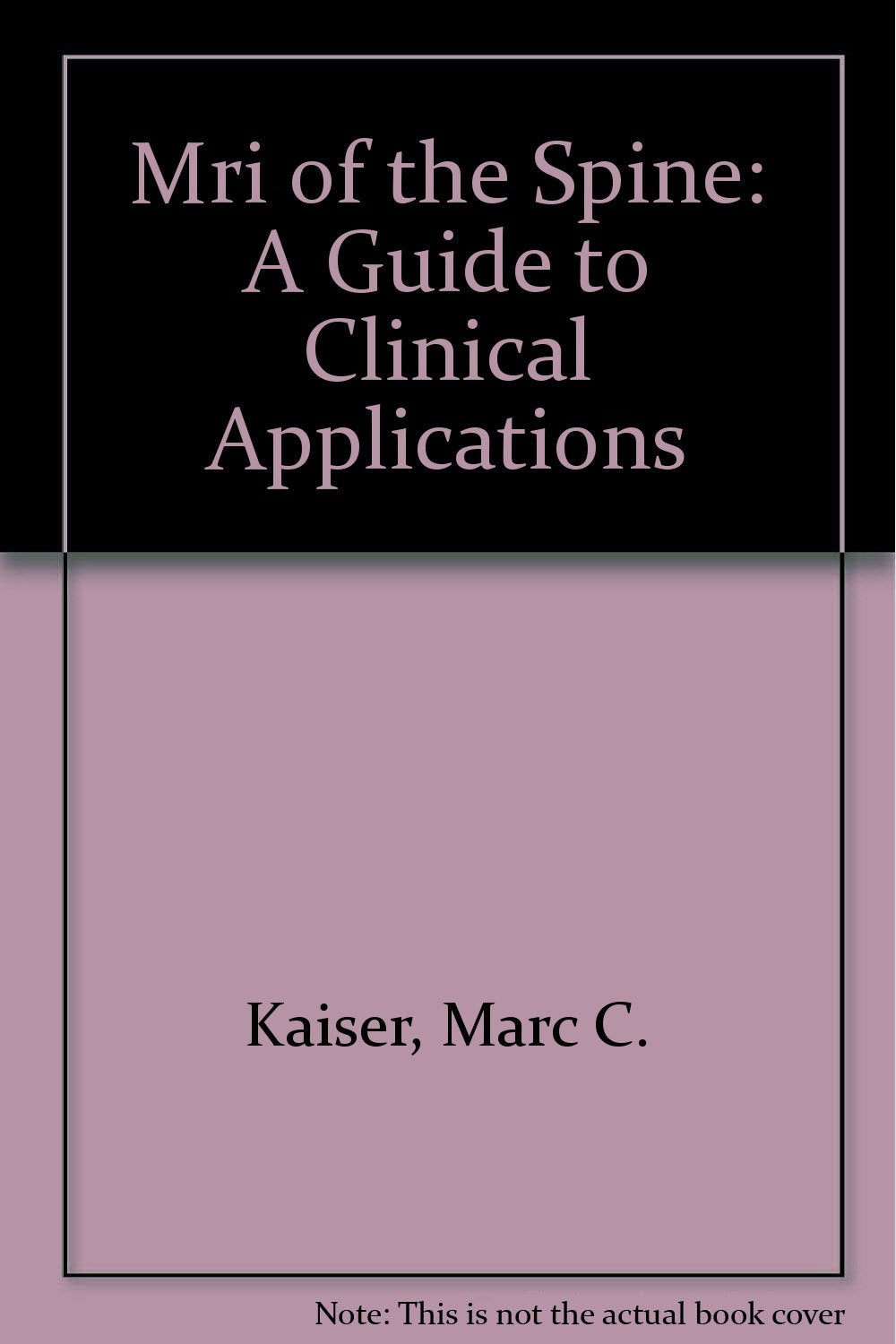 Mri of the Spine: A Guide to Clinical Applications,Used