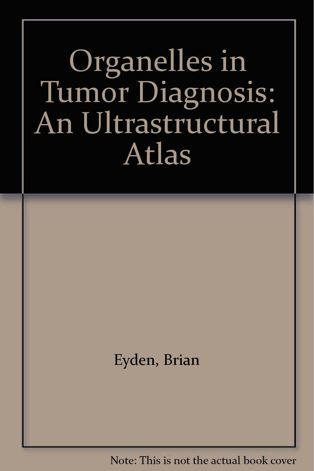 Organelles in Tumor Diagnosis: An Ultrastructural Atlas,Used