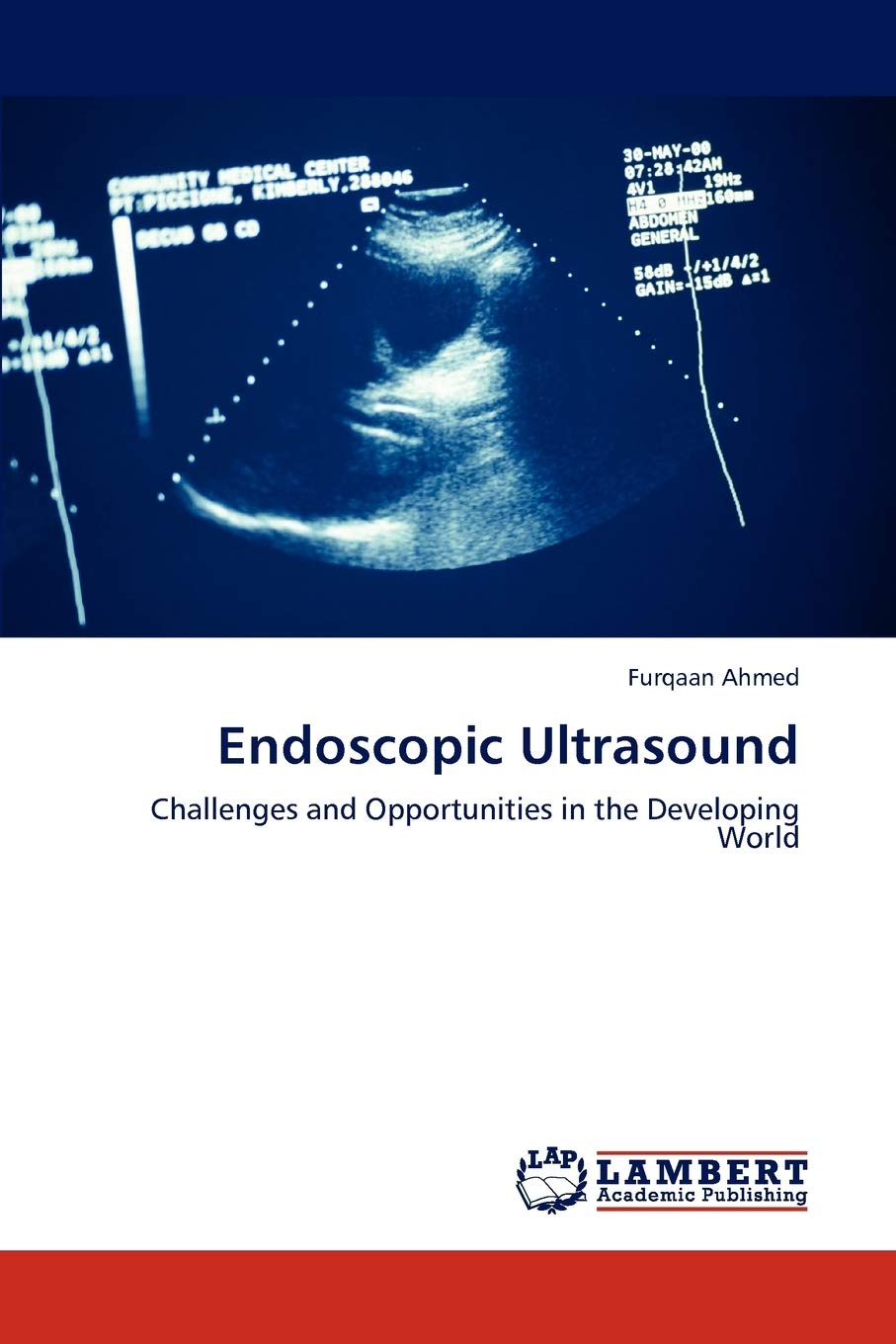 Endoscopic Ultrasound: Challenges and Opportunities in the Developing World,Used