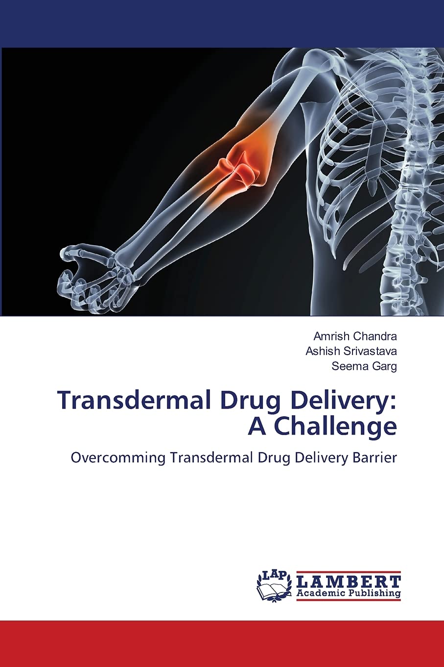 Transdermal Drug Delivery: A Challenge: Overcomming Transdermal Drug Delivery Barrier,Used