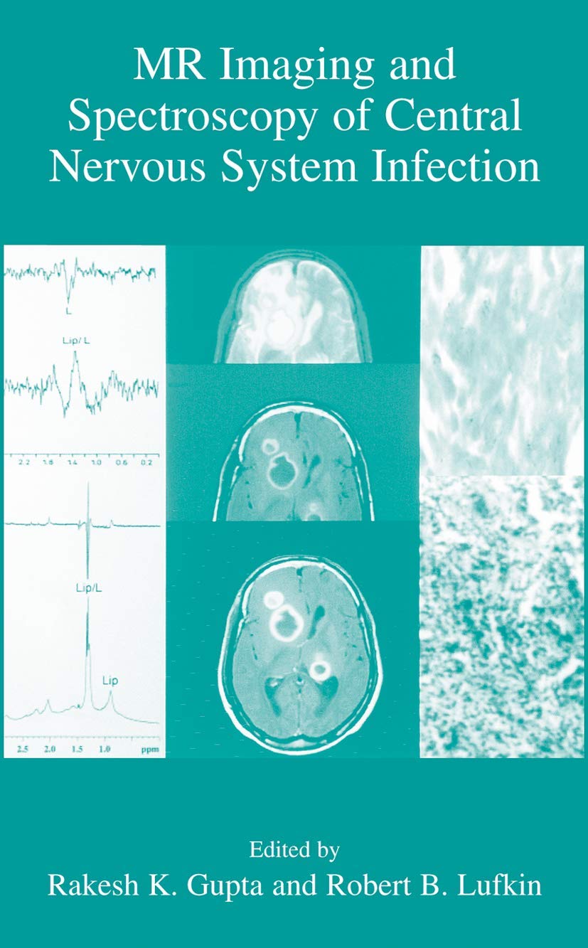 MR Imaging and Spectroscopy of Central Nervous System Infection,New