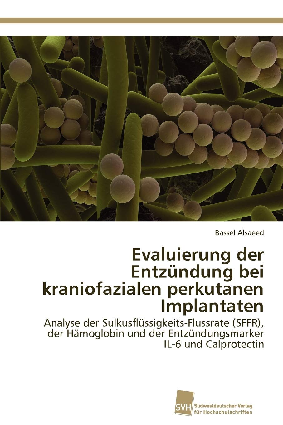 Evaluierung der Entzndung bei kraniofazialen perkutanen Implantaten: Analyse der SulkusflssigkeitsFlussrate (SFFR), der Hmoglob,Used