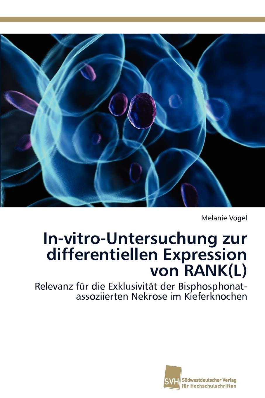 InvitroUntersuchung zur differentiellen Expression von RANK(L): Relevanz fr die Exklusivitt der Bisphosphonatassoziierten Nek,Used