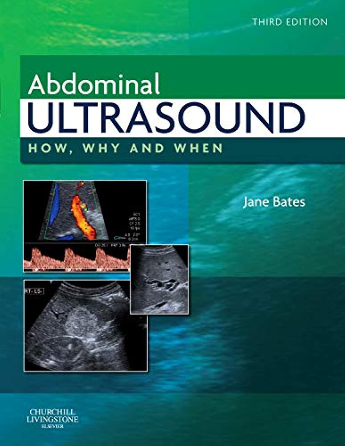 Abdominal Ultrasound: How, Why And When