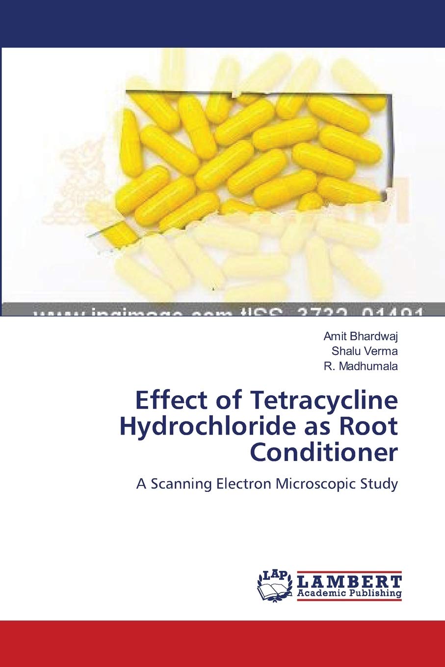 Effect Of Tetracycline Hydrochloride As Root Conditioner: A Scanning Electron Microscopic Study,Used