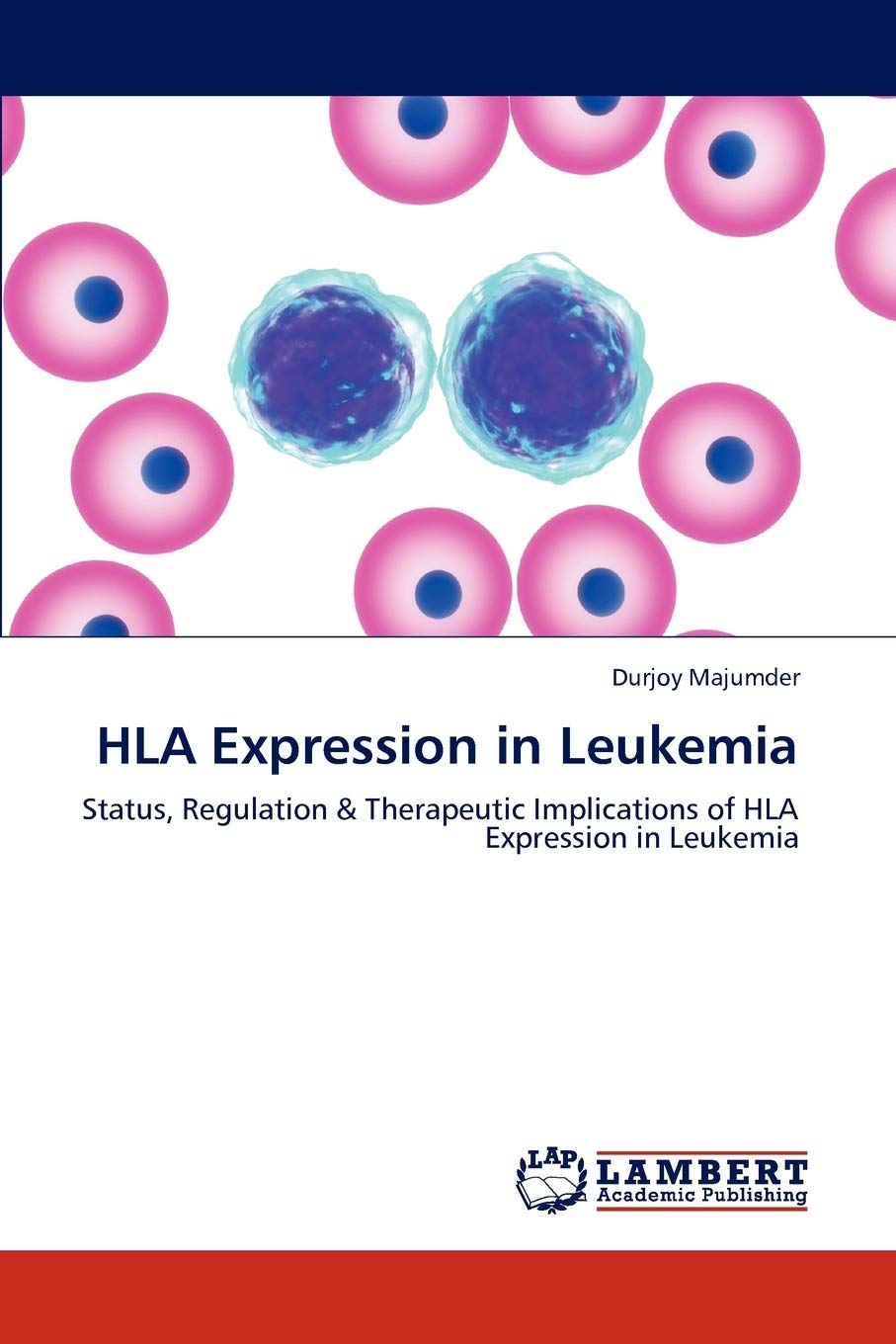 HLA Expression in Leukemia: Status, Regulation & Therapeutic Implications of HLA Expression in Leukemia,Used
