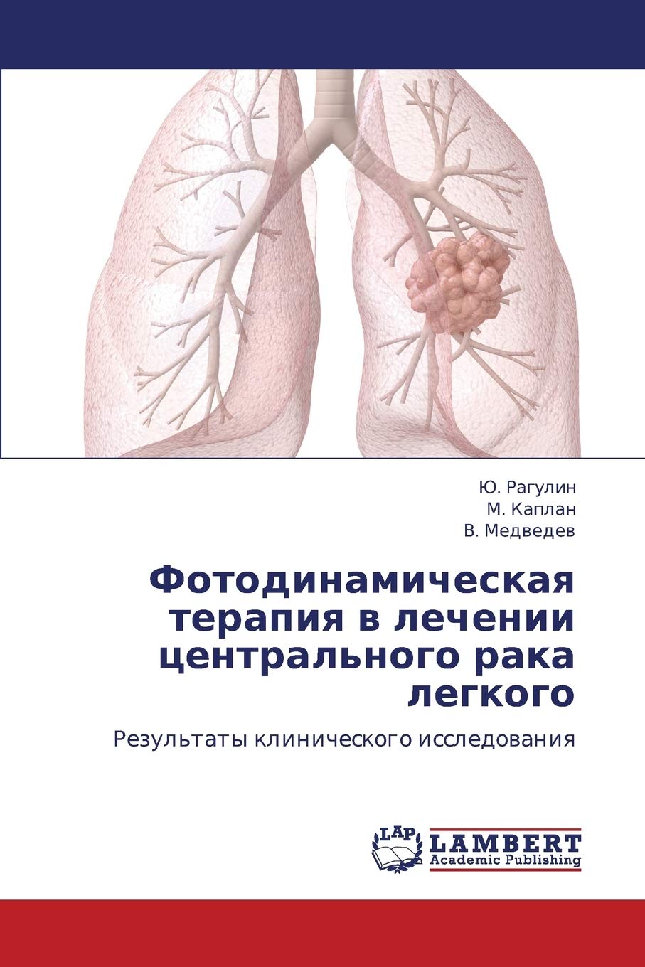 Fotodinamicheskaya terapiya v lechenii tsentral'nogo raka legkogo: Rezul'taty klinicheskogo issledovaniya (Russian Edition),Used