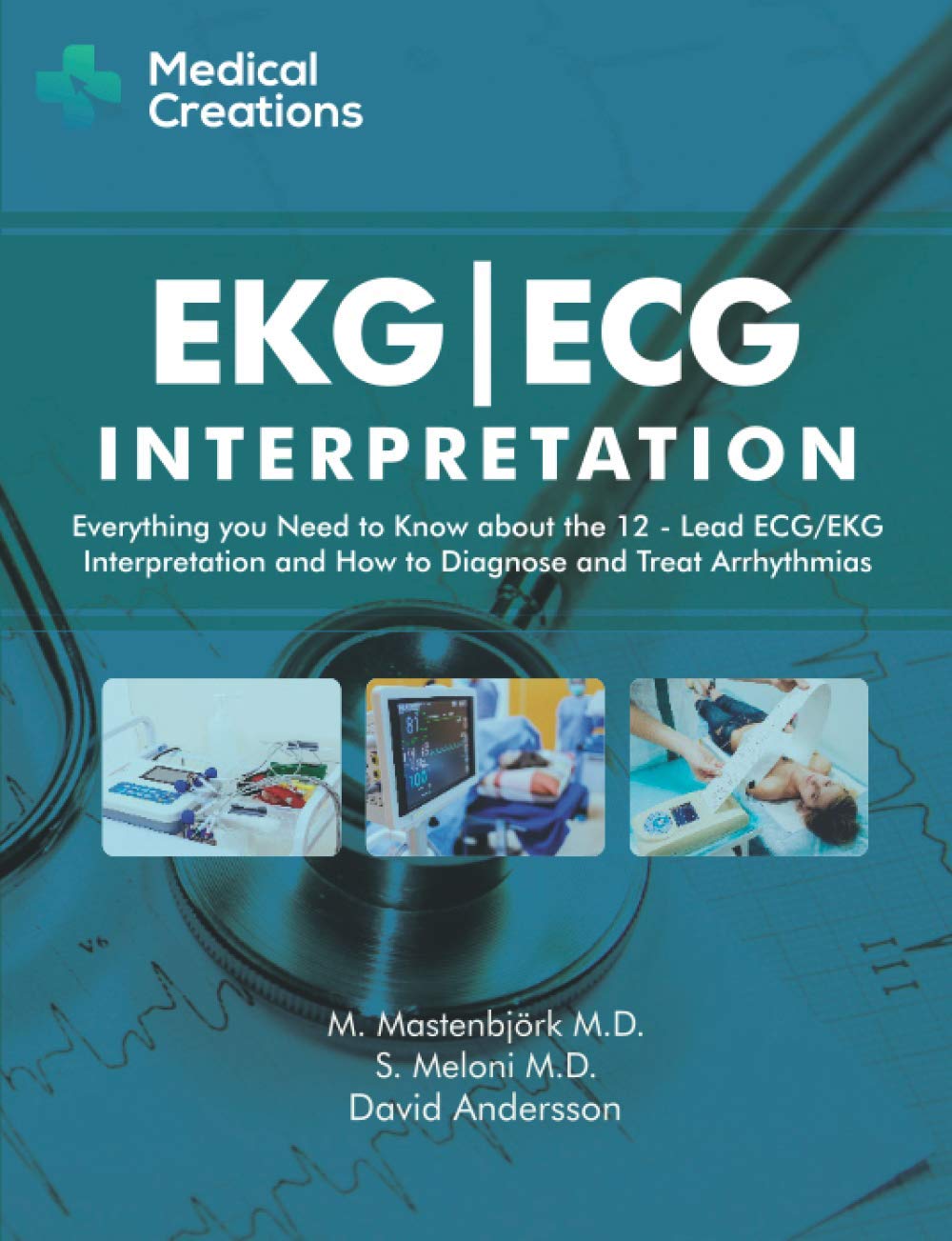 Ekg/Ecg Interpretation: Everything You Need To Know About The 12Lead Ecg/Ekg Interpretation And How To Diagnose And Treat Arrhy