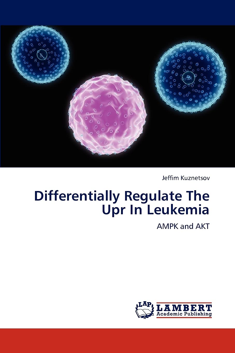 Differentially Regulate The Upr In Leukemia: AMPK and AKT,Used