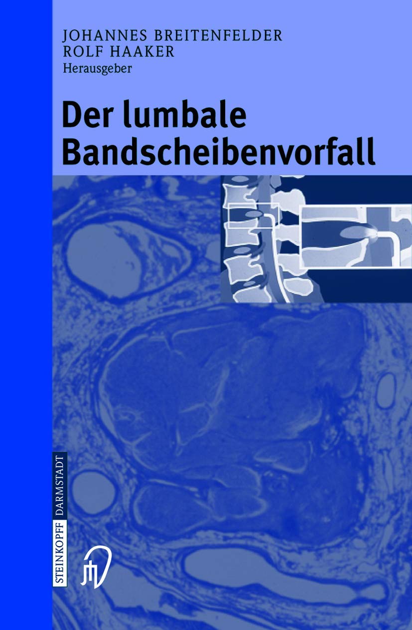 Der lumbale Bandscheibenvorfall (German Edition),Used