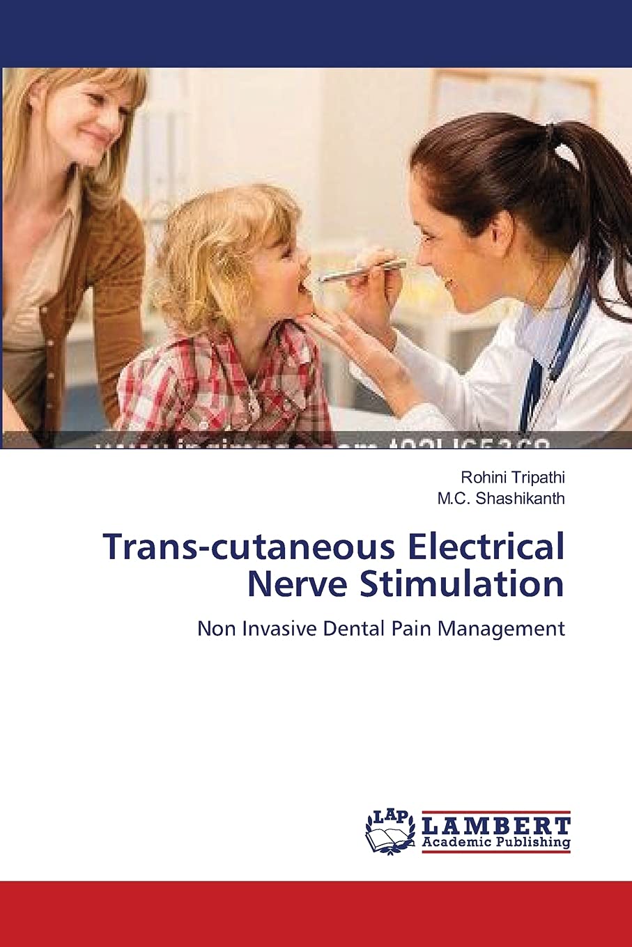 Transcutaneous Electrical Nerve Stimulation: Non Invasive Dental Pain Management,Used