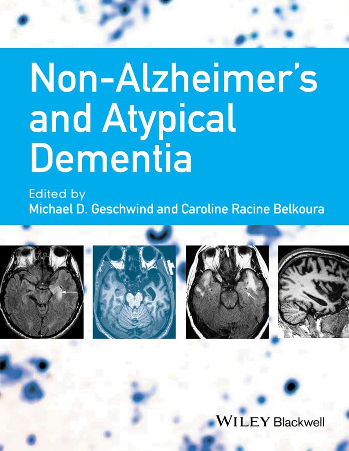 NonAlzheimer's and Atypical Dementia,Used