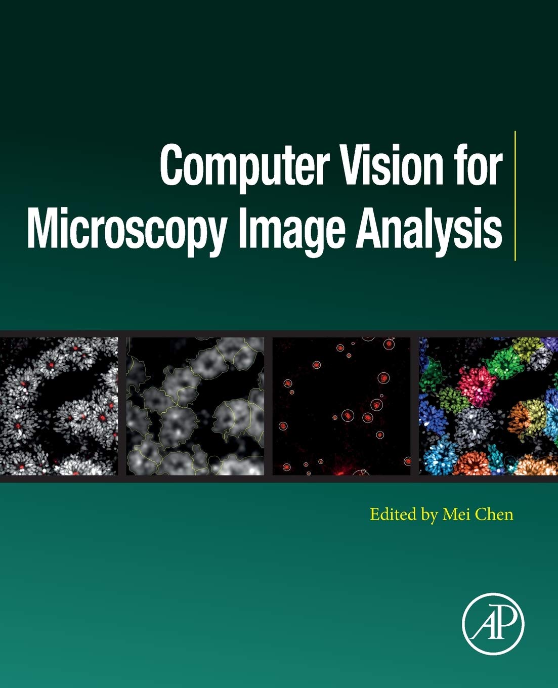 Computer Vision for Microscopy Image Analysis (Computer Vision and Pattern Recognition),Used