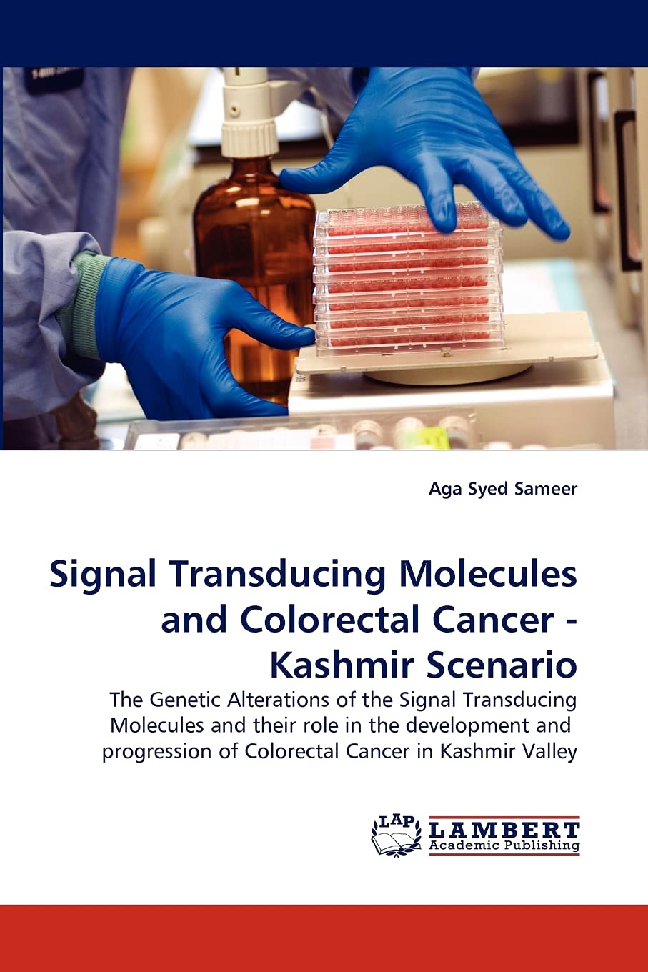 Signal Transducing Molecules and Colorectal Cancer Kashmir Scenario,Used