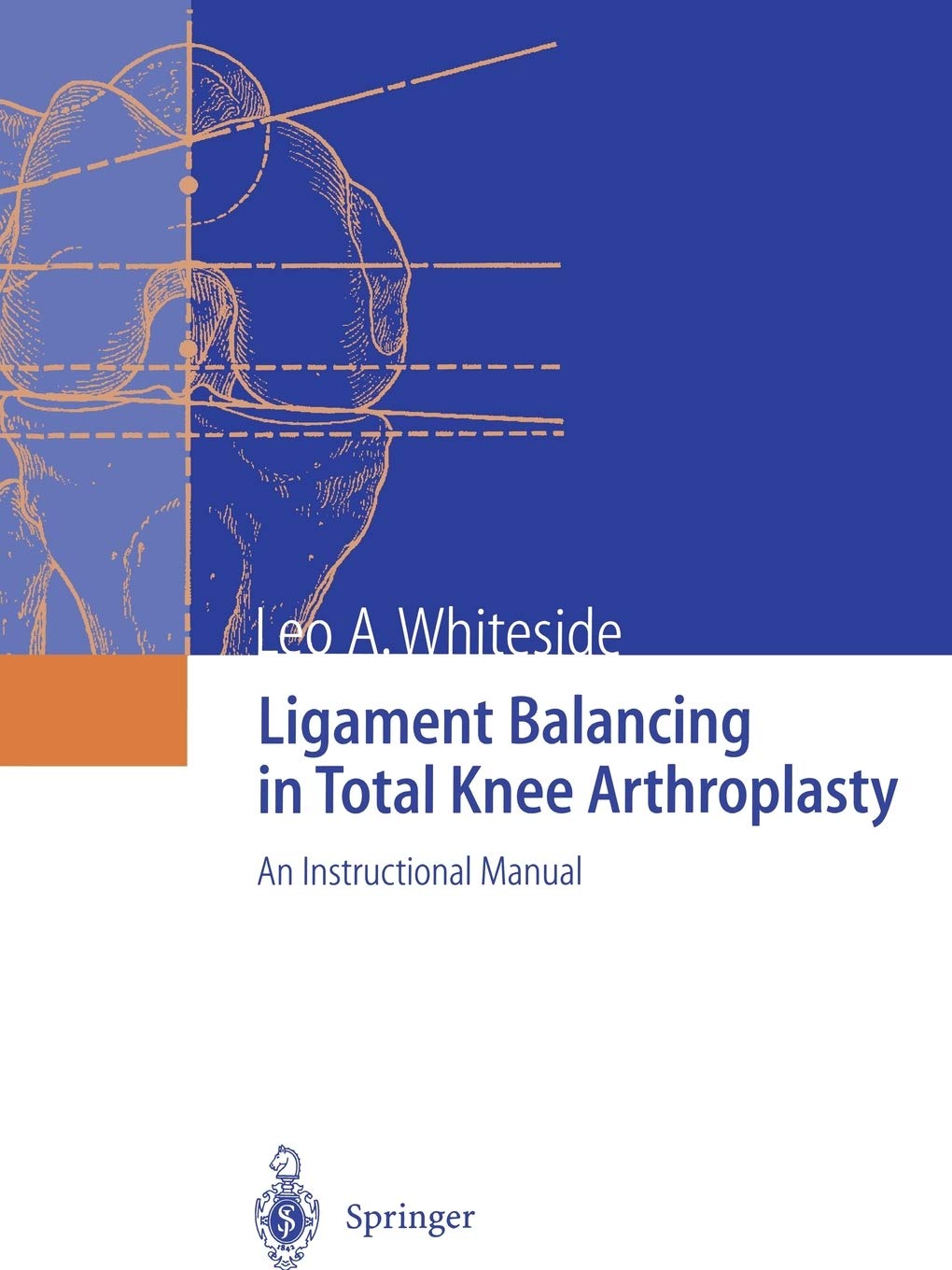 Ligament Balancing In Total Knee Arthroplasty: An Instructional Manual,Used