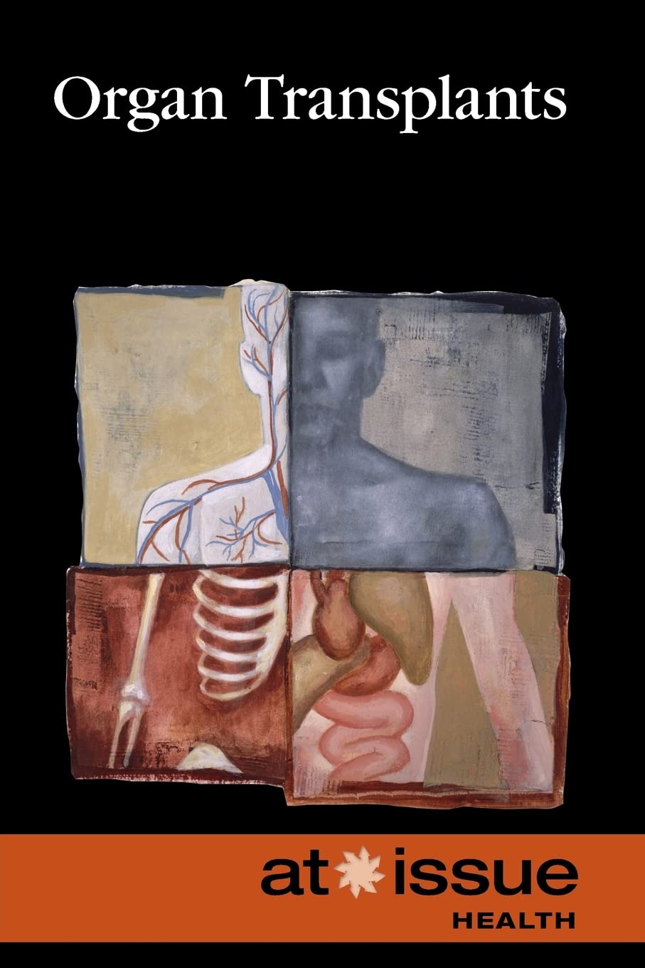 Organ Transplants (At Issue),Used