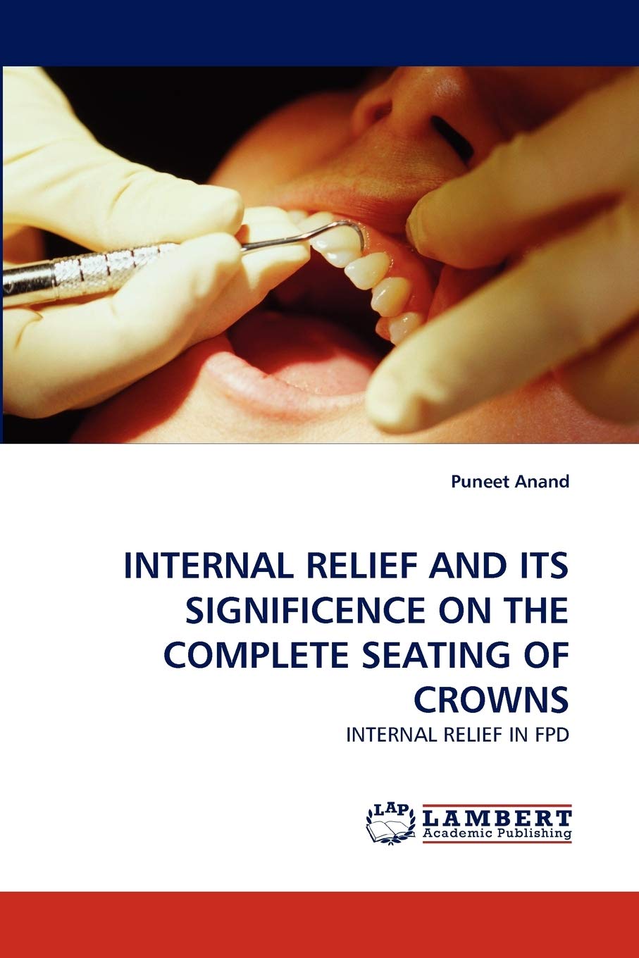INTERNAL RELIEF AND ITS SIGNIFICENCE ON THE COMPLETE SEATING OF CROWNS: INTERNAL RELIEF IN FPD,Used