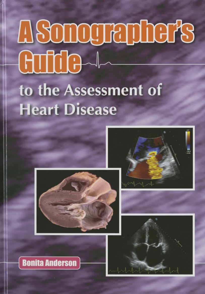 Sonographer's Guide to the Assessment of Heart Disease,Used