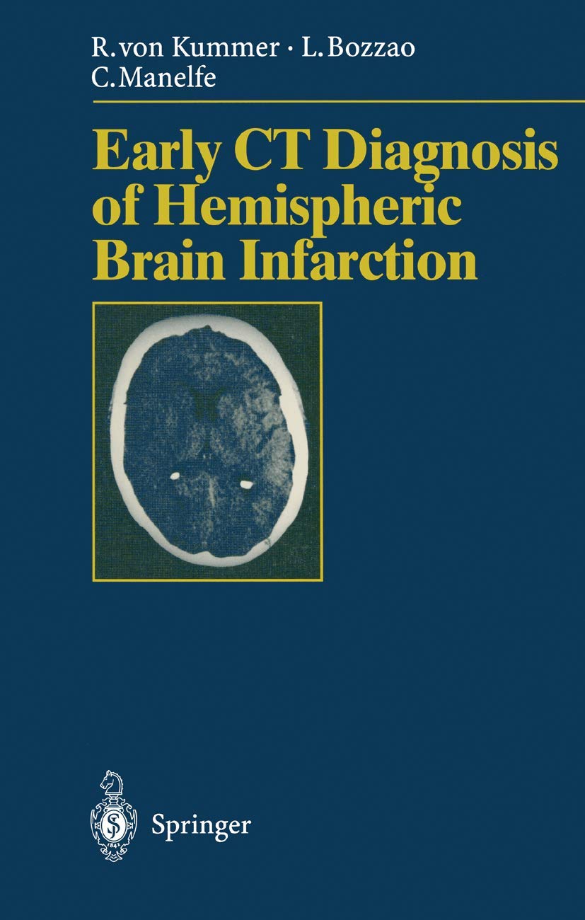 Early CT Diagnosis of Hemispheric Brain Infarction,Used