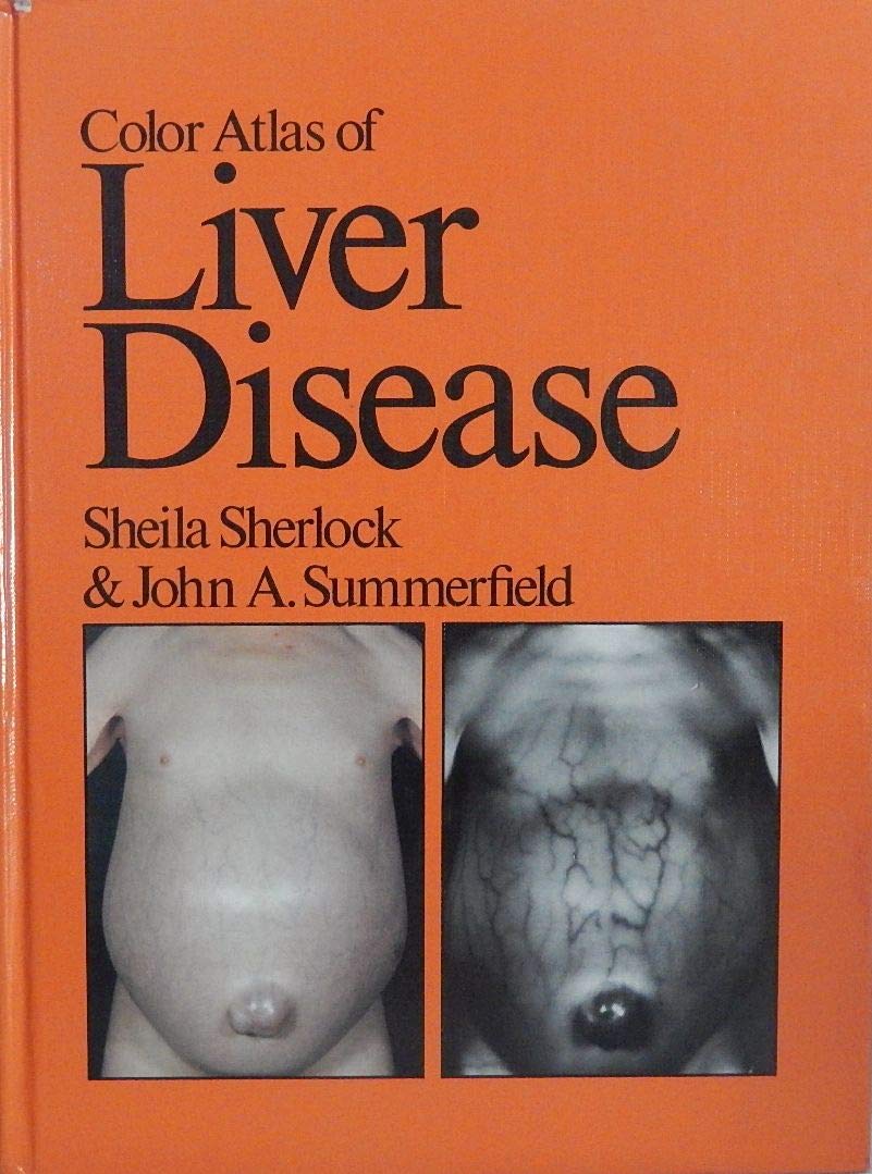 Color atlas of liver disease,Used
