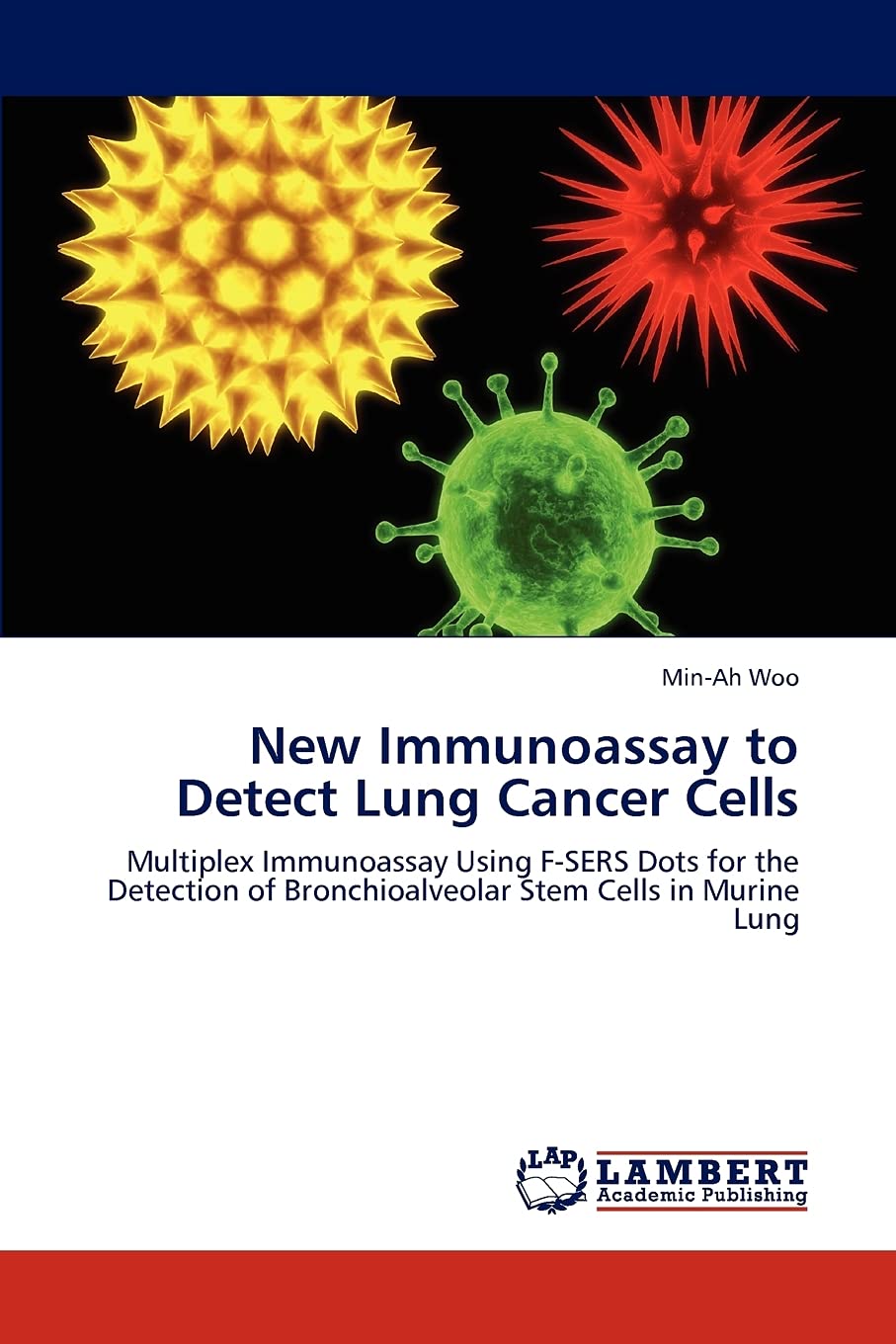 New Immunoassay to Detect Lung Cancer Cells: Multiplex Immunoassay Using FSERS Dots for the Detection of Bronchioalveolar Stem ,Used