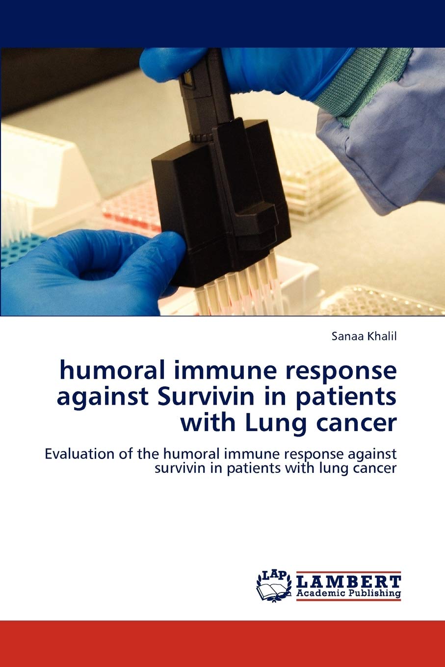 humoral immune response against Survivin in patients with Lung cancer: Evaluation of the humoral immune response against survivi,Used