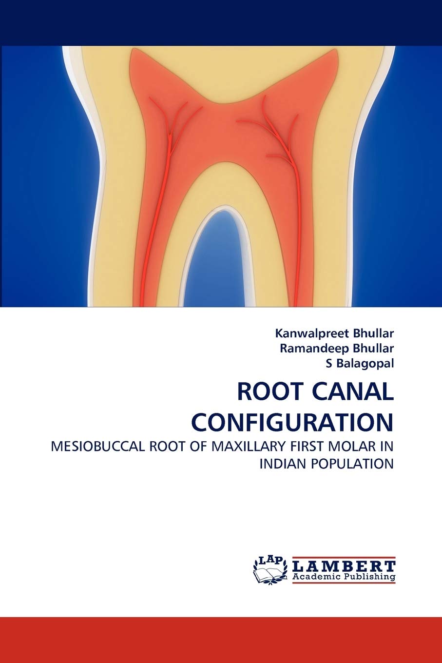 ROOT CANAL CONFIGURATION: MESIOBUCCAL ROOT OF MAXILLARY FIRST MOLAR IN INDIAN POPULATION,Used