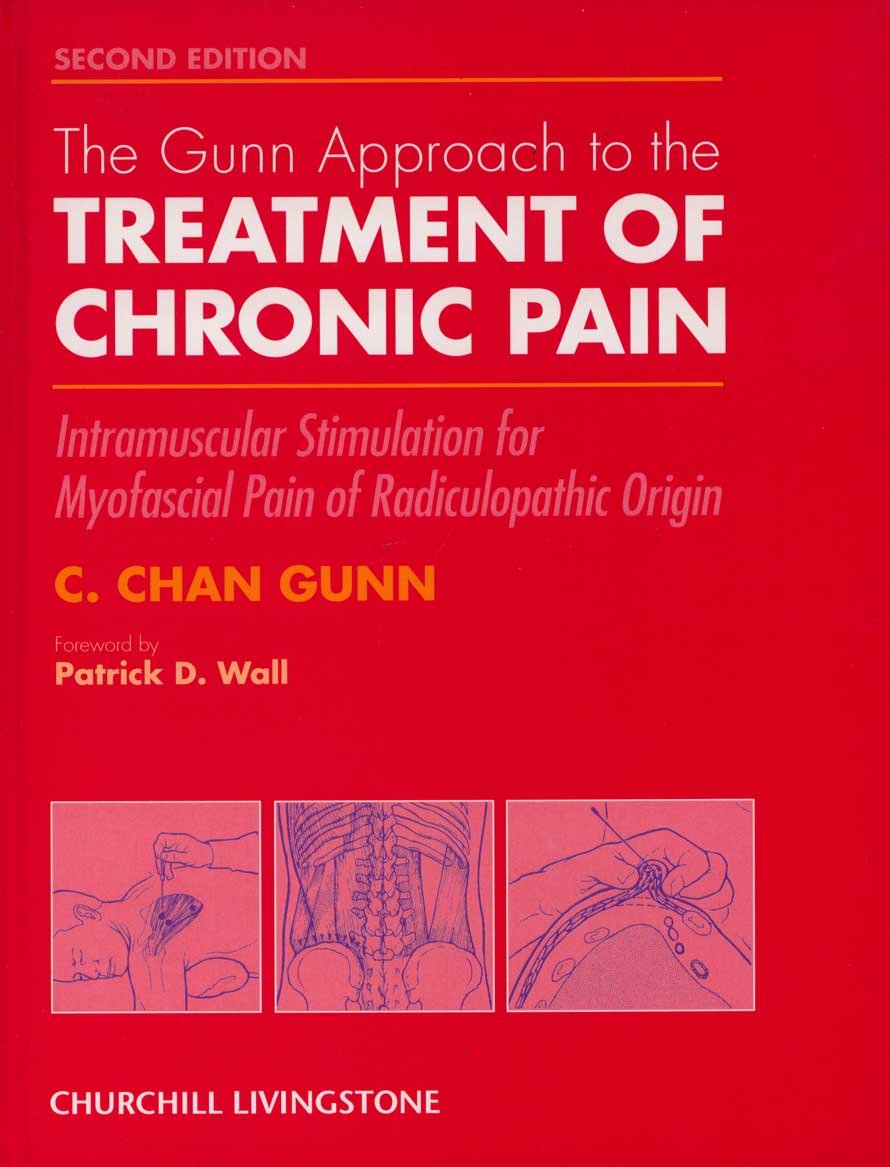 The Gunn Approach to the Treatment of Chronic Pain: Intramuscular Stimulation for Myofascial Pain of Radiculopathic Origin,New