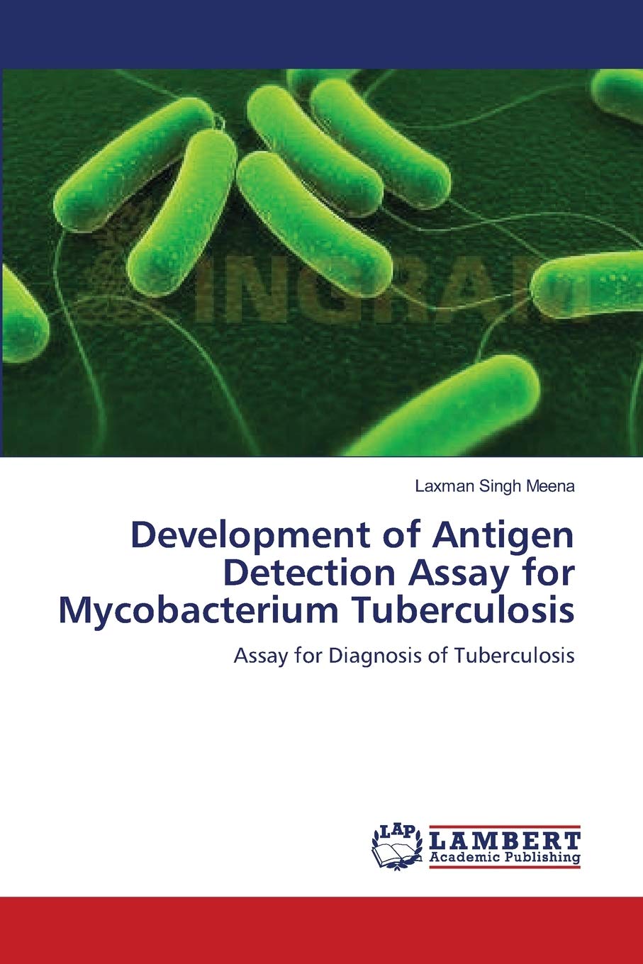 Development of Antigen Detection Assay for Mycobacterium Tuberculosis: Assay for Diagnosis of Tuberculosis,Used