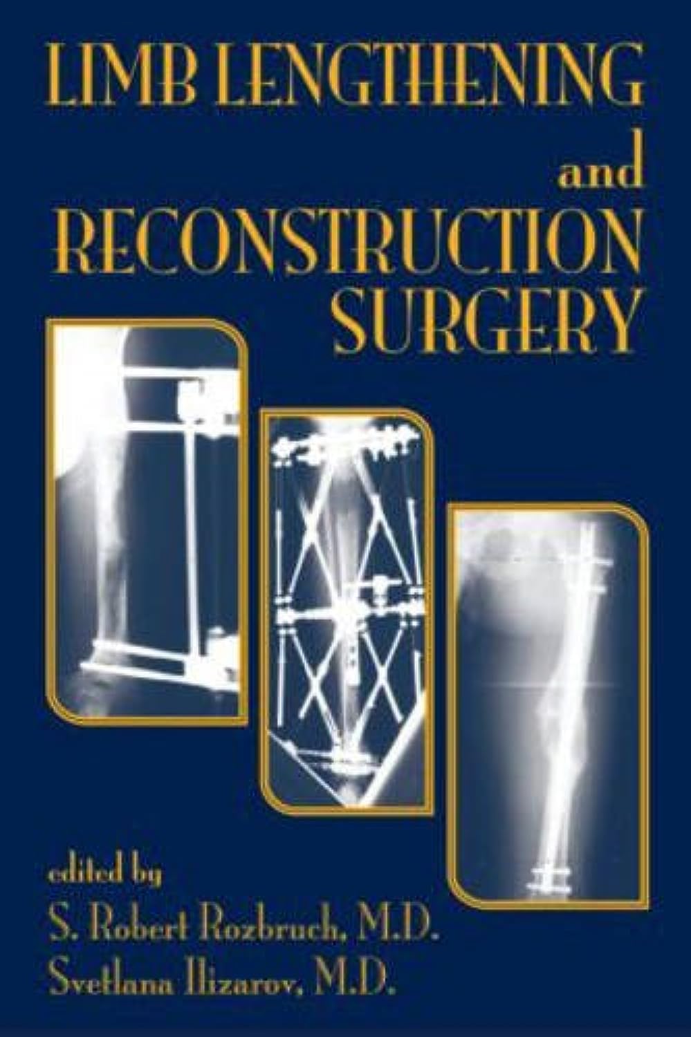 Limb Lengthening And Reconstruction Surgery,Used