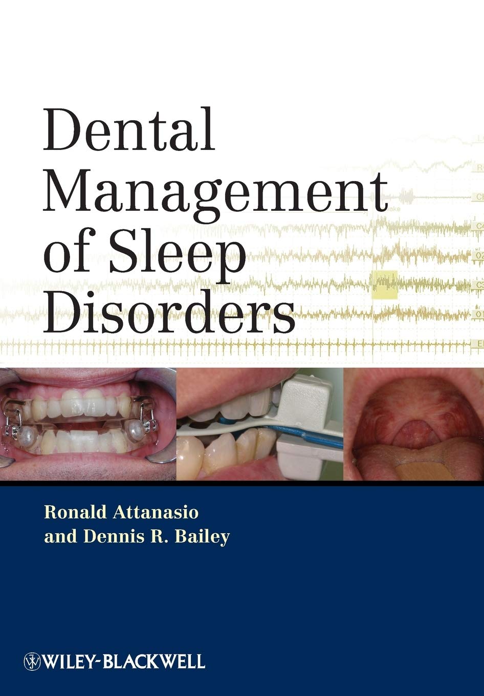 Dental Management Of Sleep Disorders,Used