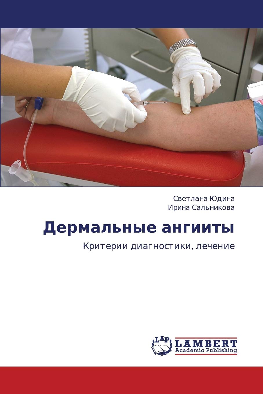 Dermal'nye angiity: Kriterii diagnostiki, lechenie (Russian Edition),Used