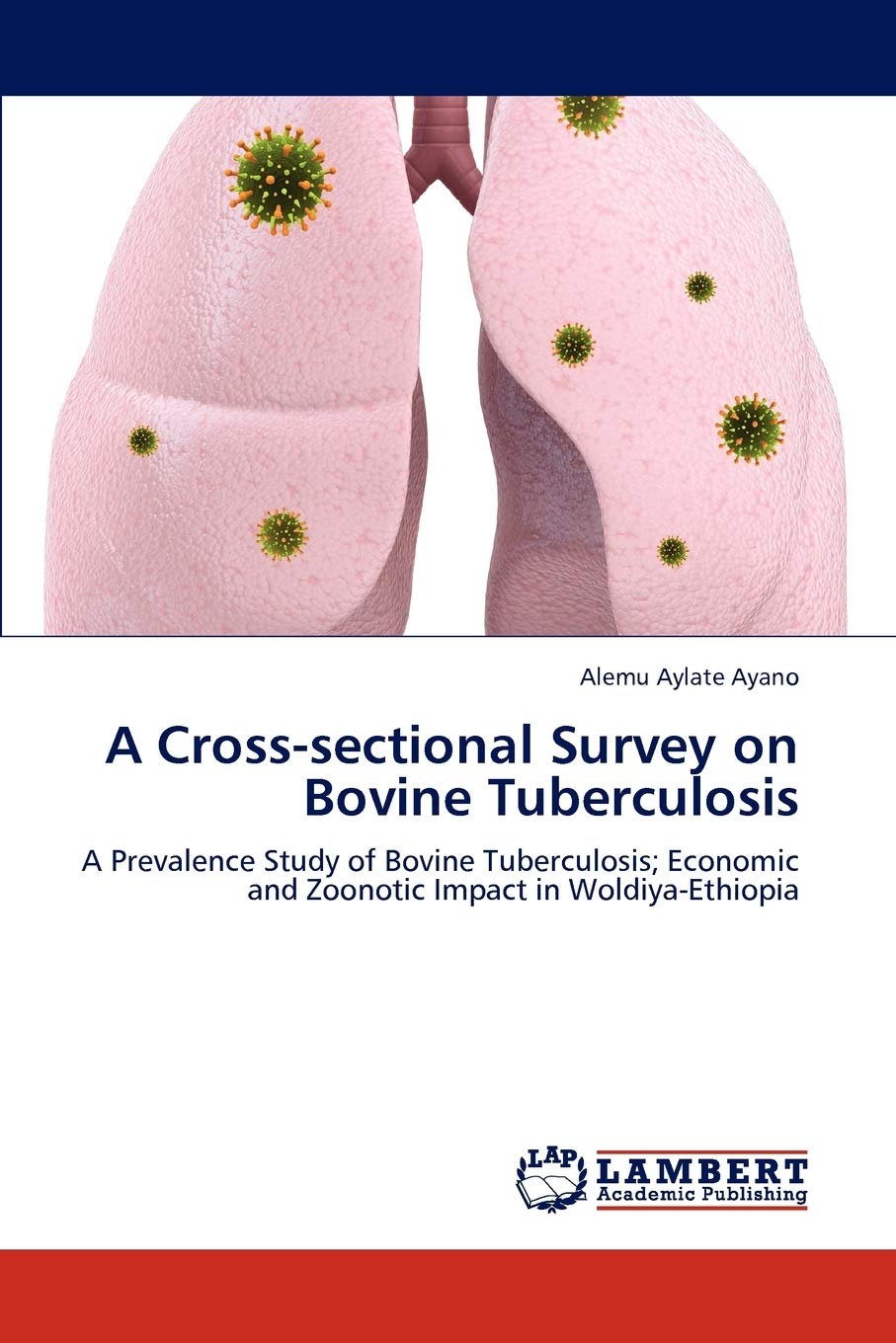 A Crosssectional Survey on Bovine Tuberculosis: A Prevalence Study of Bovine Tuberculosis; Economic and Zoonotic Impact in Wold,Used