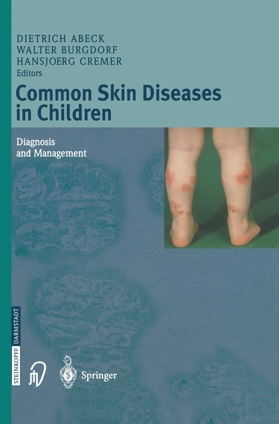 Common Skin Diseases in Children: Diagnosis and Management,Used