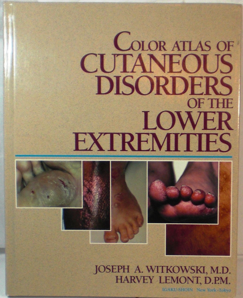 Color Atlas of Cutaneous Disorders of the Lower Extremities,Used