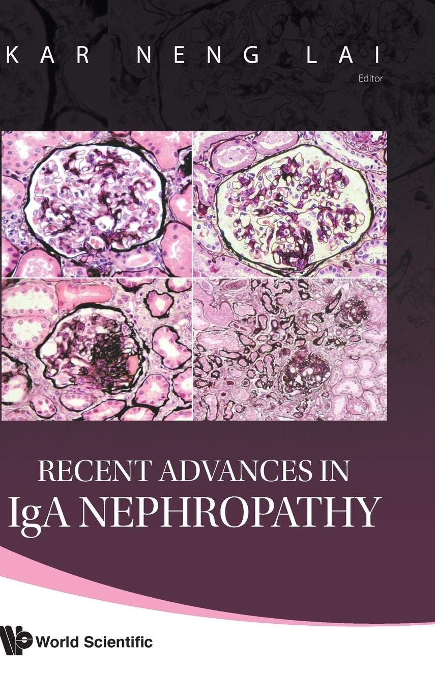 RECENT ADVANCES IN IGA NEPHROPATHY,Used