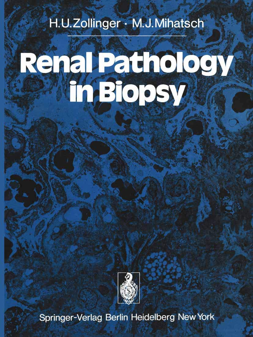 Renal Pathology in Biopsy: Light, Electron and Immunofluorescent Microscopy and Clinical Aspects,Used