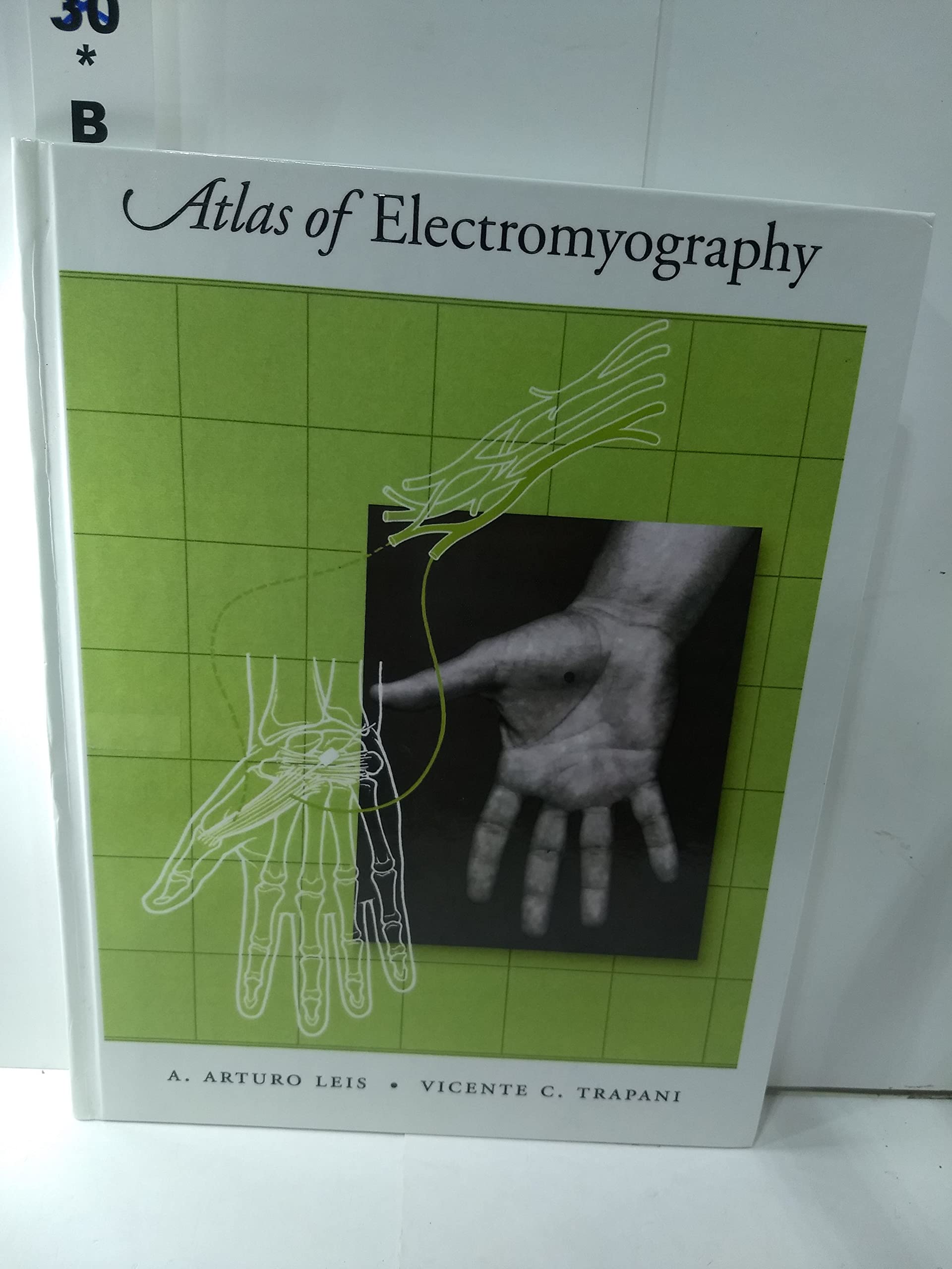 Atlas of Electromyography,Used