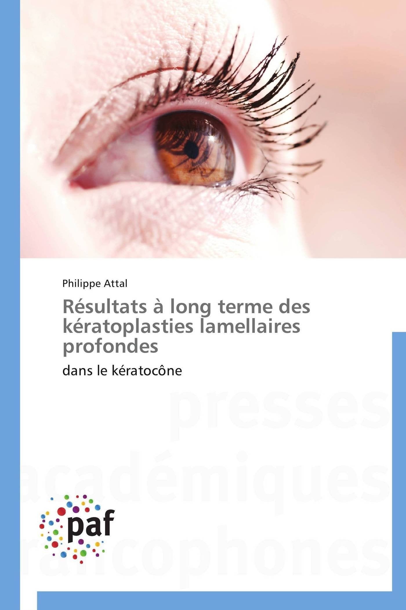 Rsultats long terme des kratoplasties lamellaires profondes: dans le kratocne (Omn.Pres.Franc.) (French Edition),Used