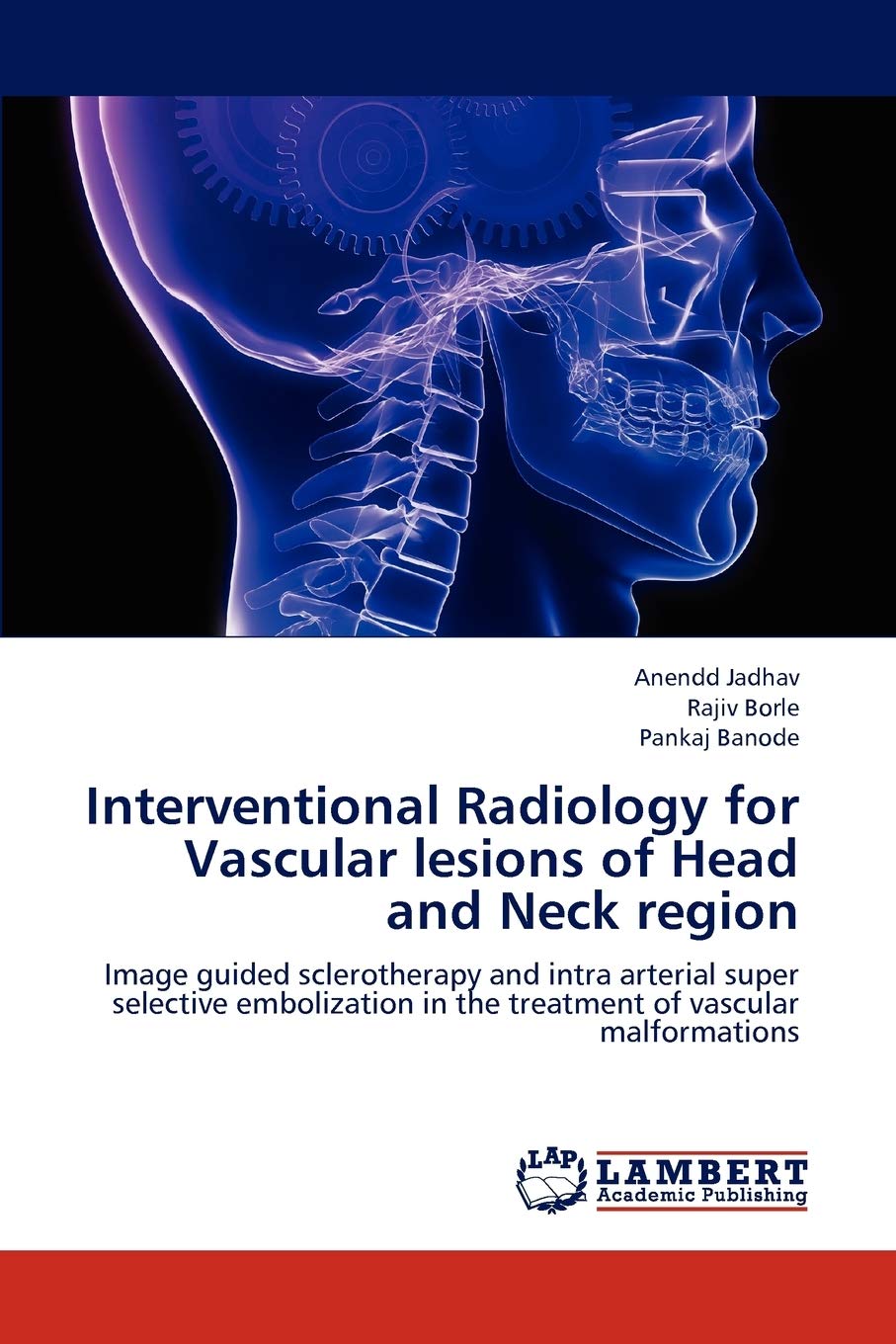 Interventional Radiology for Vascular lesions of Head and Neck region: Image guided sclerotherapy and intra arterial super selec,Used