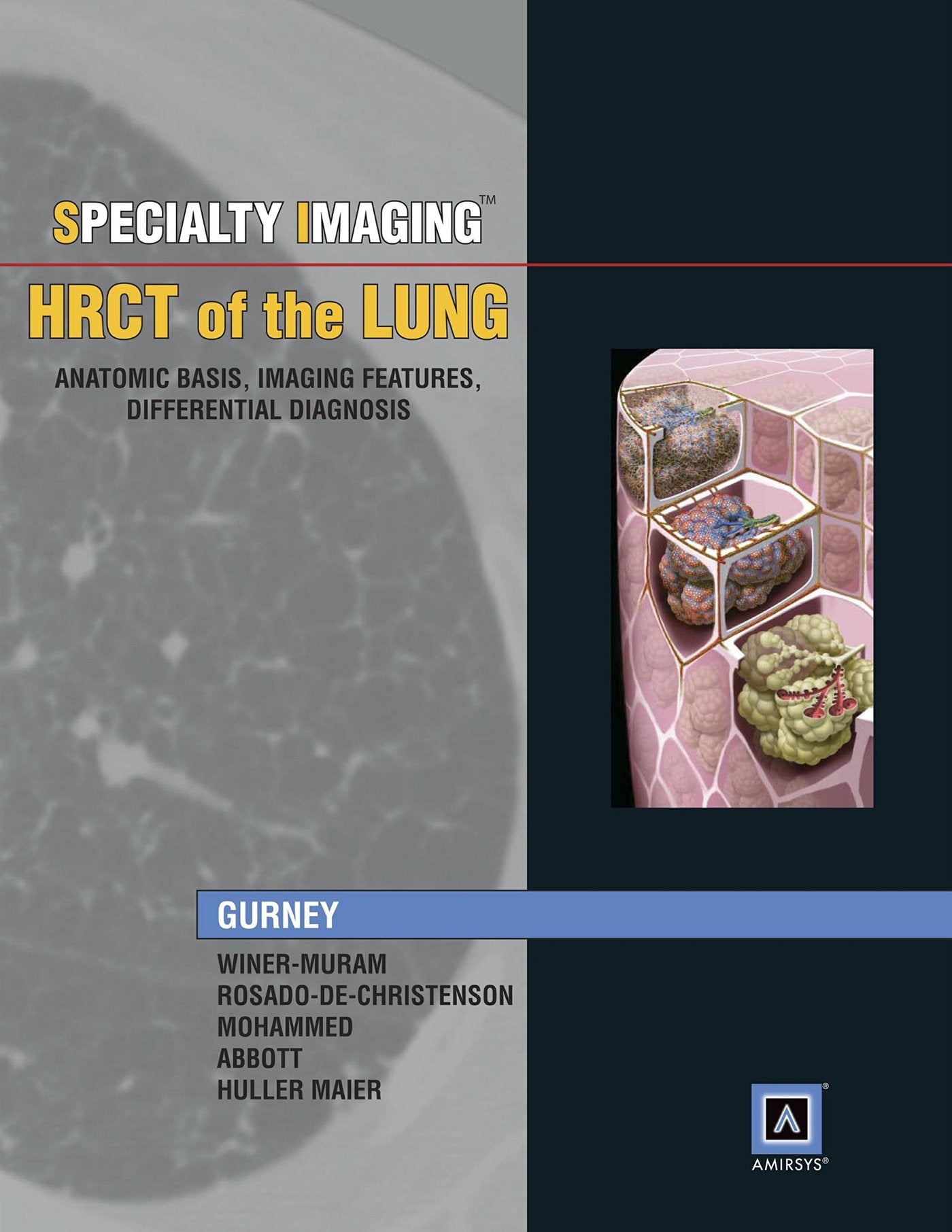 Specialty Imaging: HRCT of the Lung, Anatomic Basis, Imaging Features, Differential Diagnosis,Used