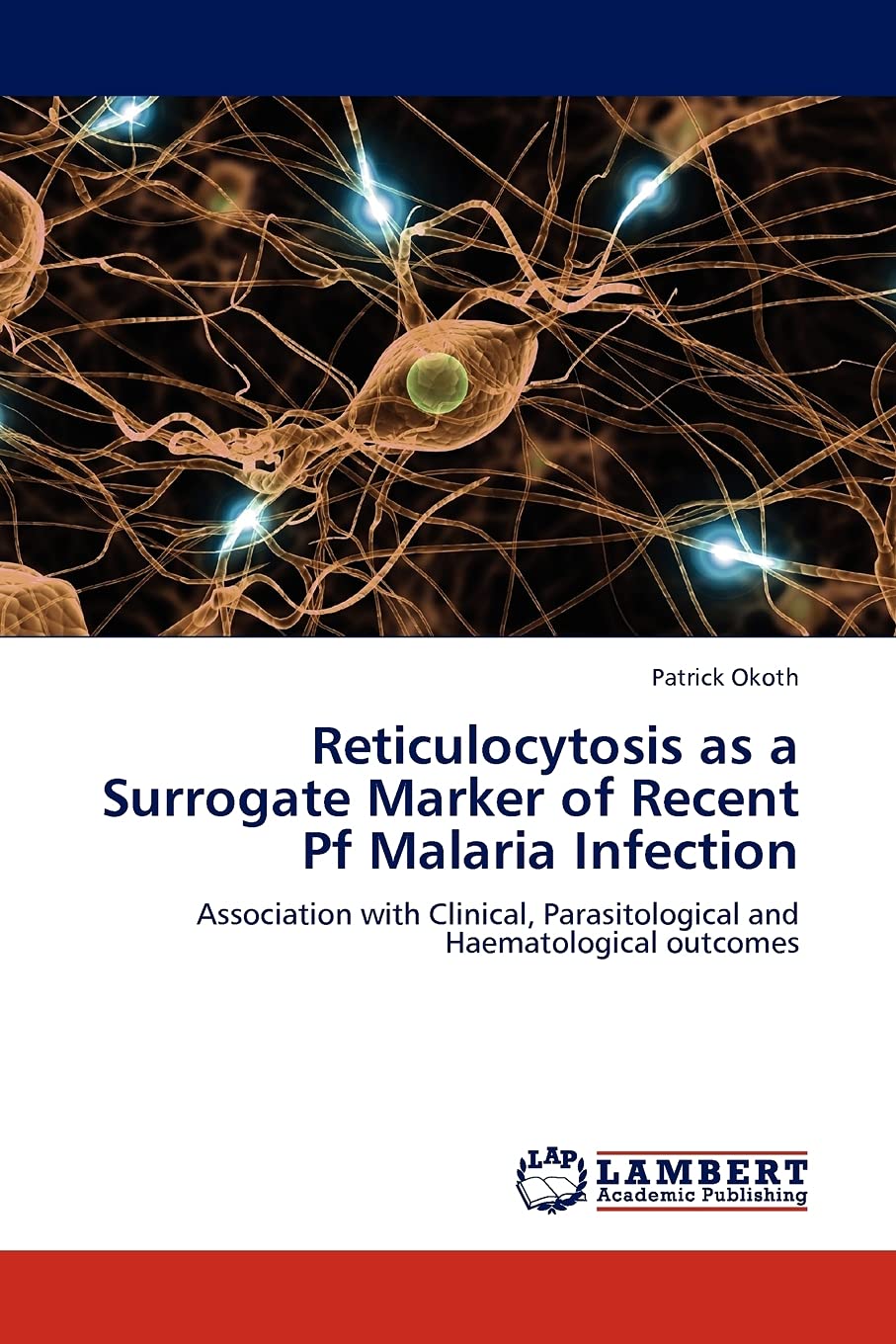 Reticulocytosis as a Surrogate Marker of Recent Pf Malaria Infection: Association with Clinical, Parasitological and Haematologi,Used