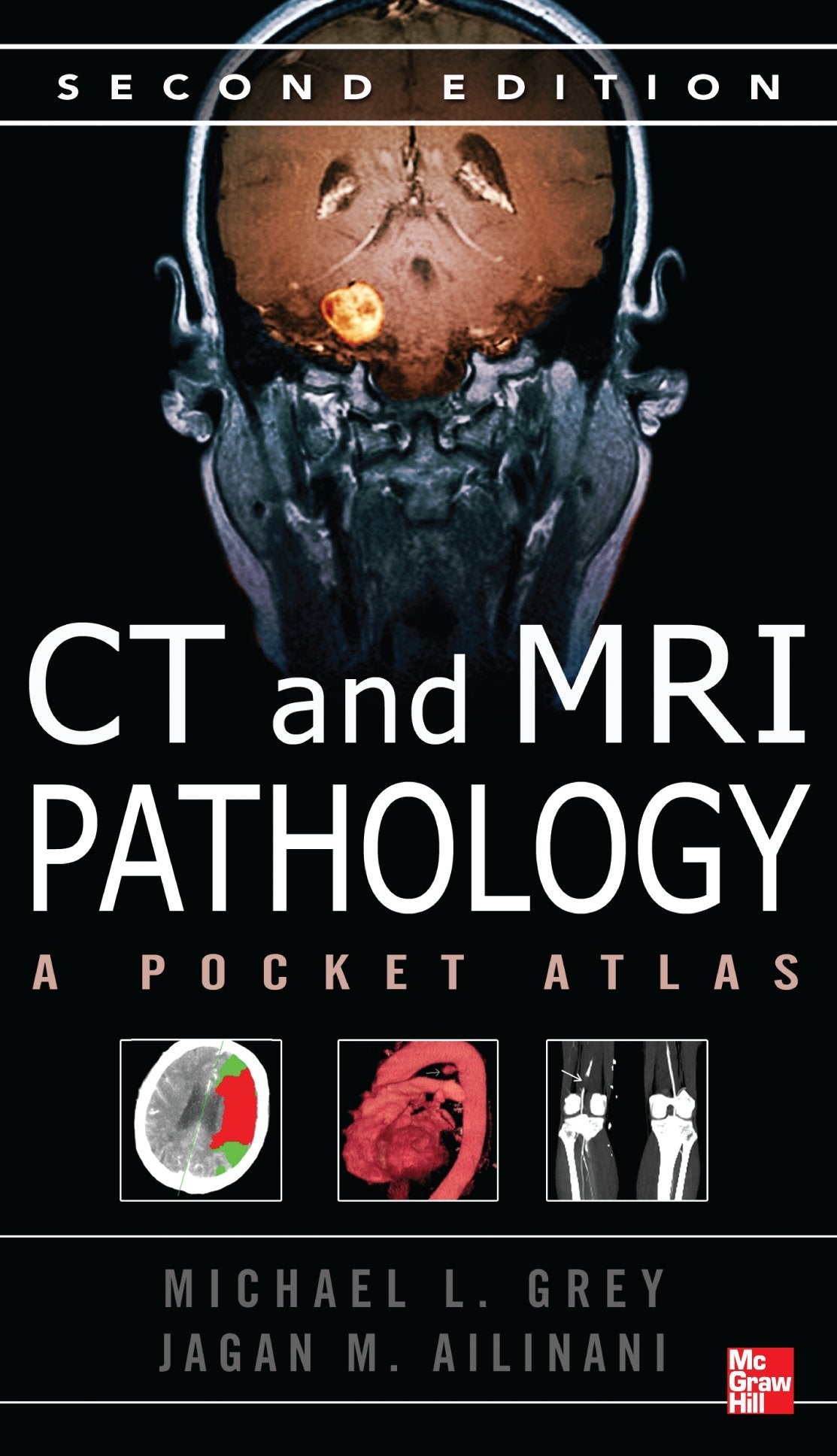 Ct & Mri Pathology: A Pocket Atlas, Second Edition