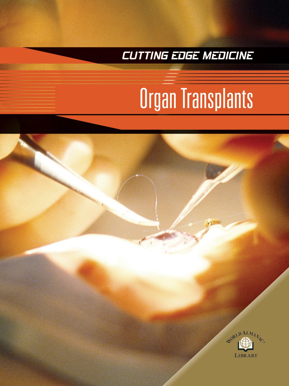 Organ Transplants (Cutting Edge Medicine),Used