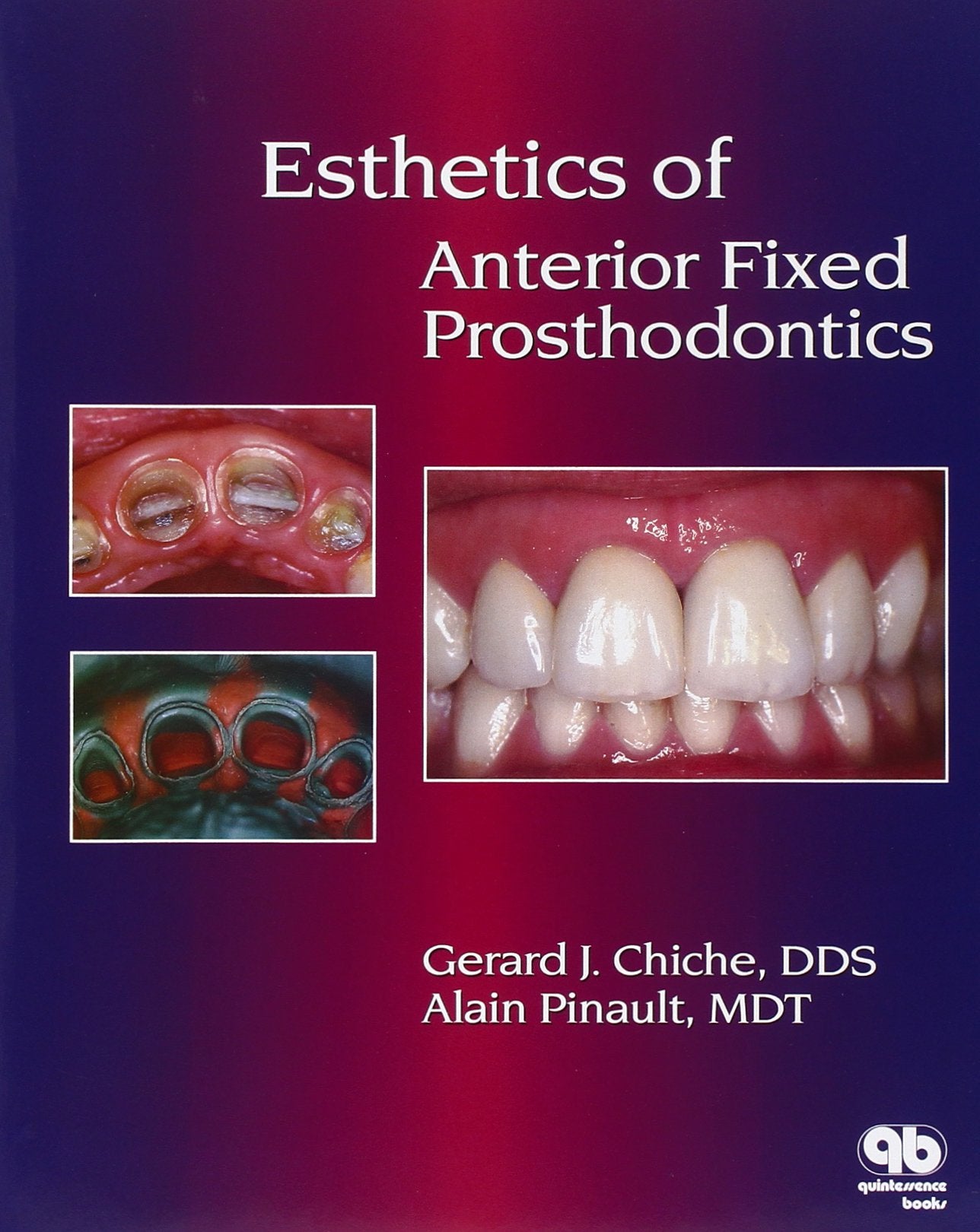 Esthetics Of Anterior Fixed Prosthodontics,New