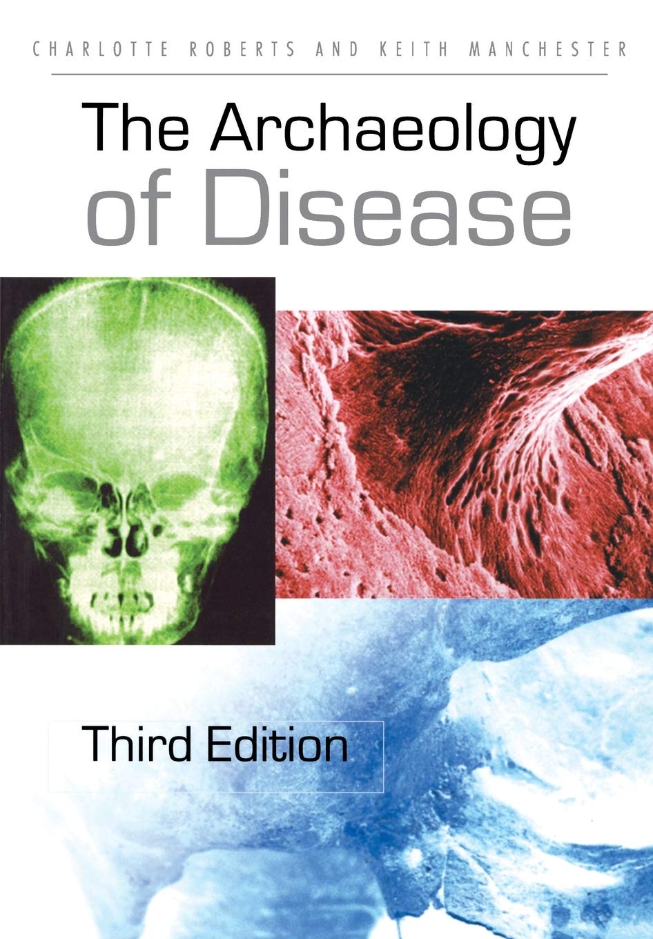 The Archaeology Of Disease,Used