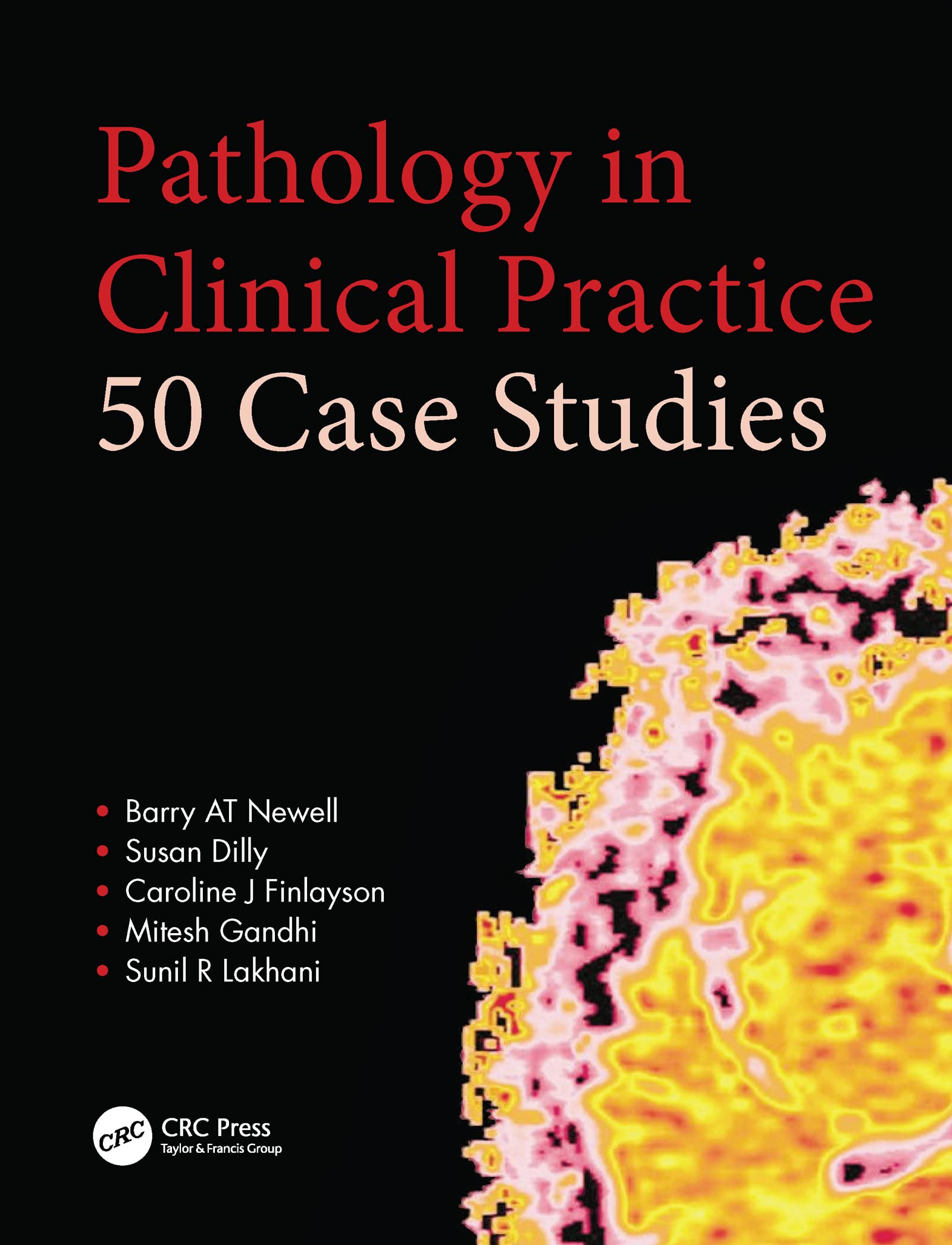 Pathology in Clinical Practice: 50 Case Studies (A Hodder Arnold Publication),Used